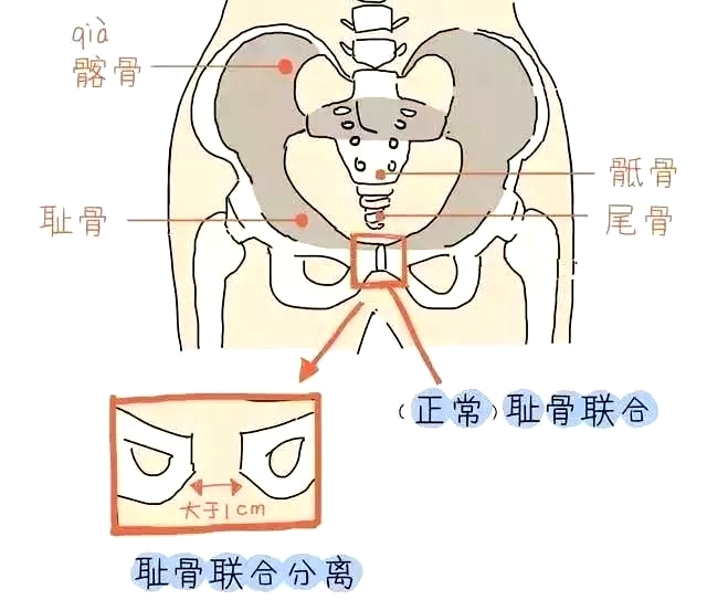 盆底肌康復(fù)治療儀，產(chǎn)后媽媽不再擔(dān)心