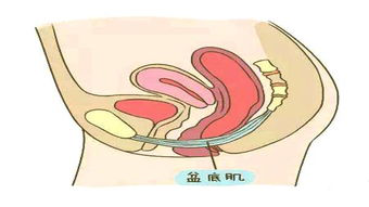 盆底肌康復(fù)治療儀，如何讓盆底肌康復(fù)評估報(bào)告更可靠