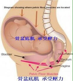 產(chǎn)后盆底康復(fù)治療開始后，出現(xiàn)陰道出血怎么破？