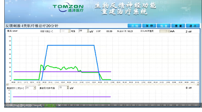 盆底康復(fù)治療怎么做？盆底康復(fù)治療肌電生物反饋治療儀的機(jī)理是什么？