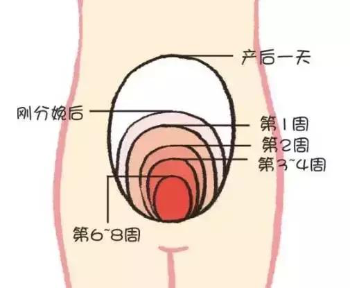 產(chǎn)后康復(fù)，什么叫子宮復(fù)舊不良？