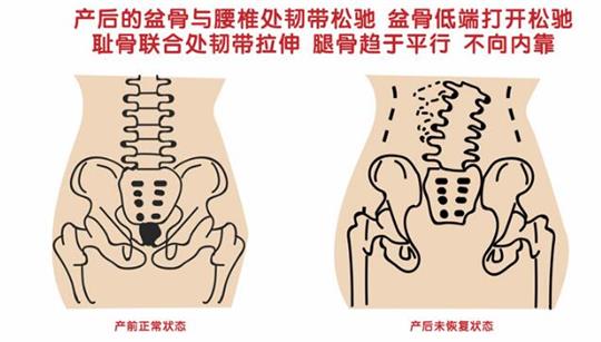 上百家產(chǎn)后修復中心店家告訴您產(chǎn)后盆底肌怎么修復