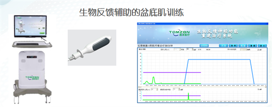 產(chǎn)后修復(fù)|盆底肌肉功能電刺激有什么作用？生物反饋呢？