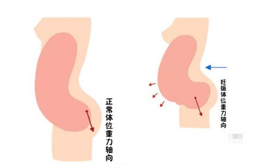 盆底恢復是否可以使用儀器？