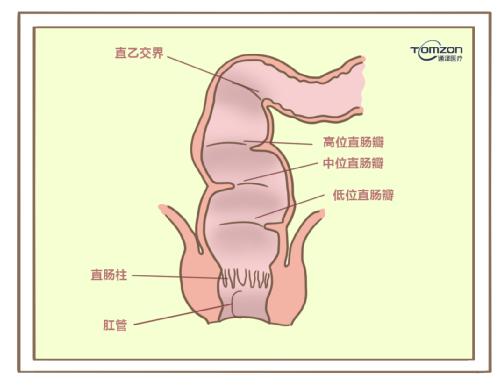 盆底康復治療儀對產(chǎn)后便秘有哪些幫助？