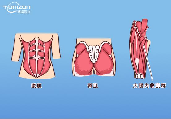 凱格爾運(yùn)動(dòng)該怎么做？盆底肌修復(fù)儀器還能用嗎？