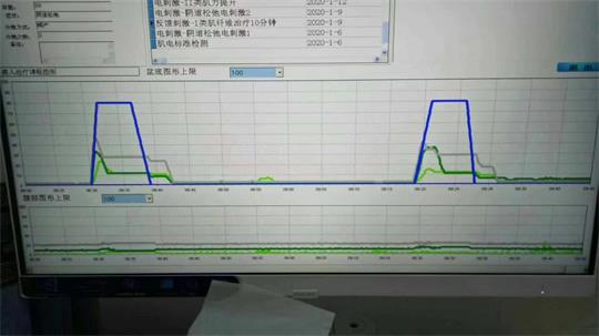 通澤子宮復(fù)舊治療儀器，痛經(jīng)不再是問題