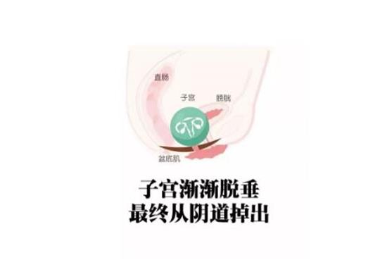 產后康復綜合治療儀|祝賀婦科門診引進專業(yè)的產康儀器