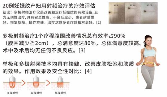 通澤產(chǎn)后塑形儀器，多極射頻破解辣媽逆齡秘訣