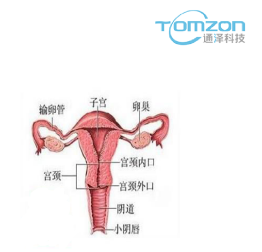 關(guān)注產(chǎn)后女性健康，子宮修復(fù)儀器的重要性