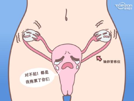 盆底康復(fù)治療儀主要是改善盆底功能障礙嗎？