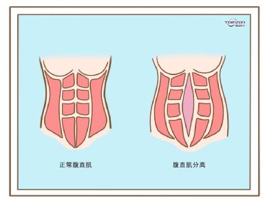 盆底康復(fù)治療儀效果到底怎么樣？