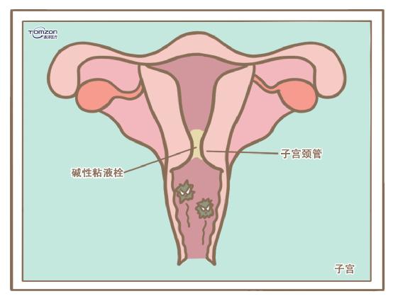 盆底康復治療儀