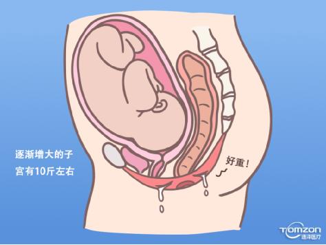 盆底康復治療儀